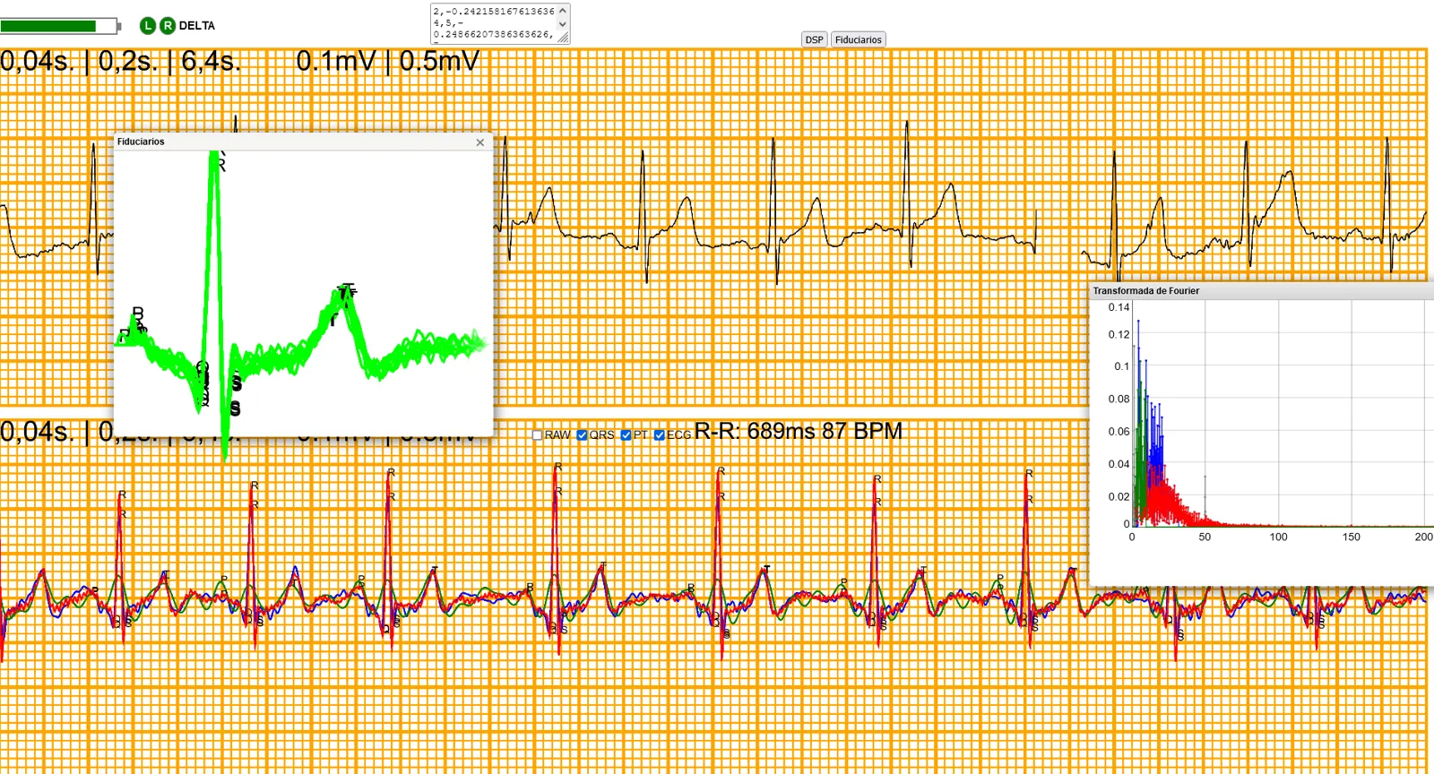 Panel del ECG con la señal, el complejo QRS ampliado y el espectro de la FFT
